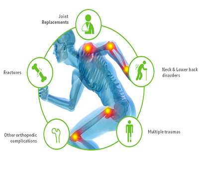 Total Knee Replacement